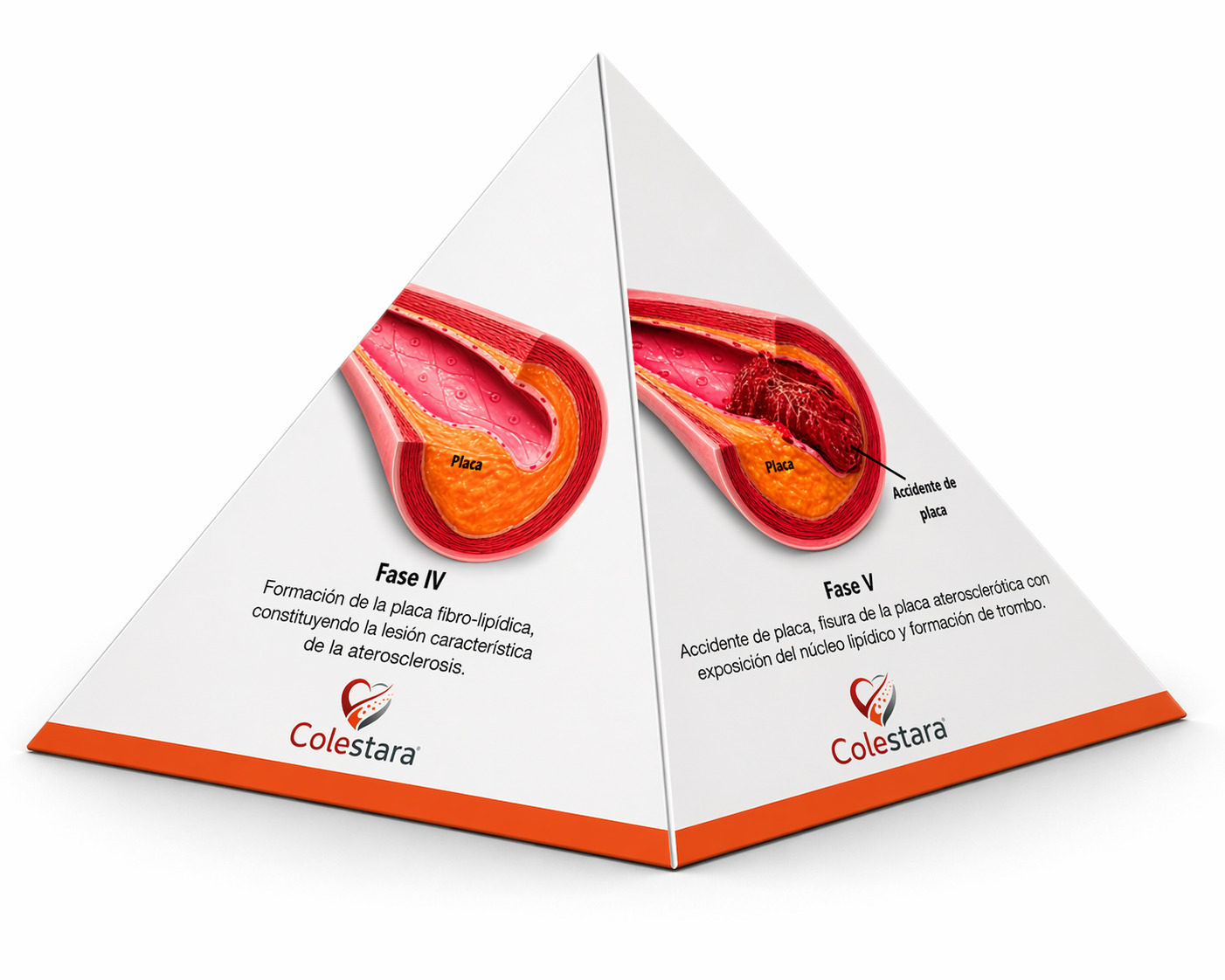 Atherosclerosis pyramid visual aid